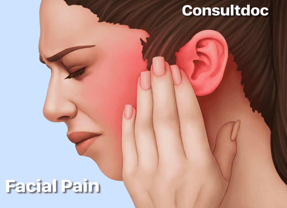 Facial Pain - Trigeminal Neuralgia
