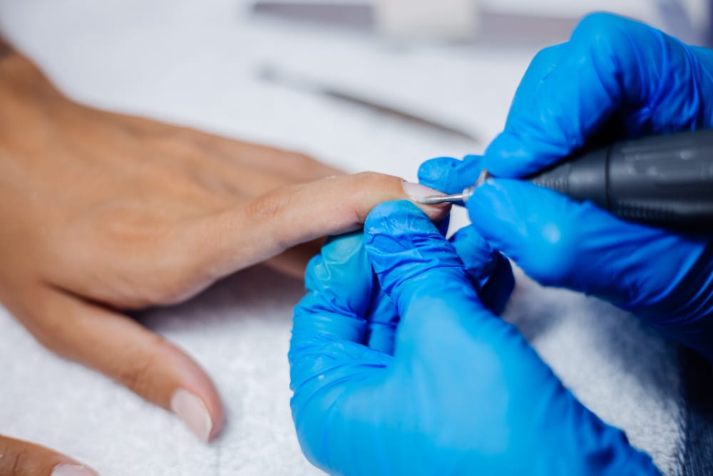 Fungal Nail Infection