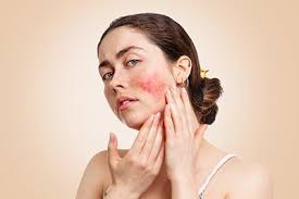 A close-up of various skin conditions displayed on different skin tones, including acne, eczema, and rosacea, highlighting the diversity and prevalence of common skin issues.